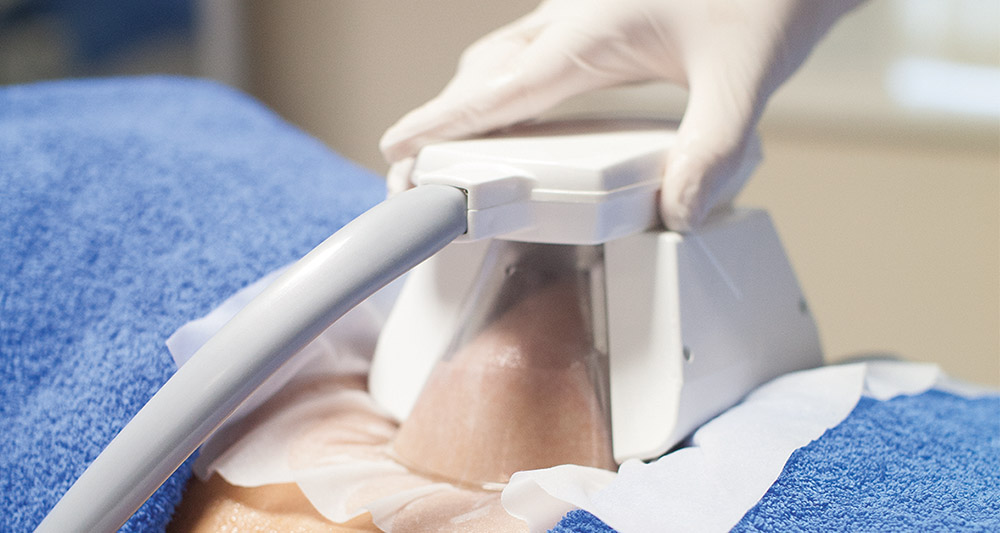 How Fat Freezing and HIFU Work Together? 2 Multiple Areas in One Session HIFU and Fat Freezing West Mersea