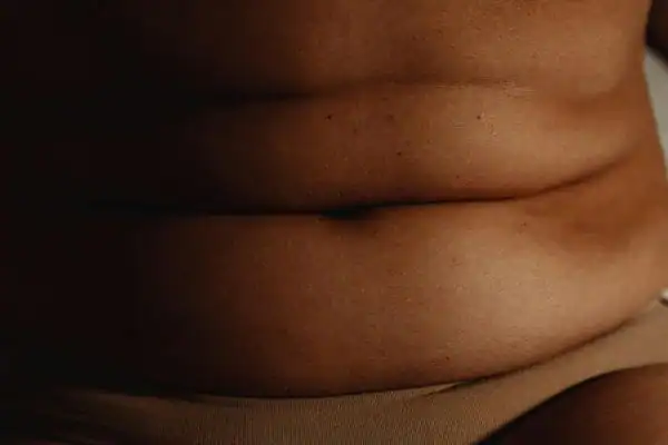 The Hidden Connection: How Stress Shapes Your Fitness and Body Composition 3 image of what stress can do on the stomach area and how Lipo 360 West Mersea can help to change your body shape.